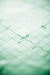 Electrocardiogram close up