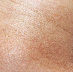 Texture Of Human Skin Leather