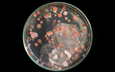 Top view soil microorganisms Nutrient agar in plate on black background.