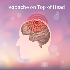 Headache on top of the head. Vector realistic anatomy illustration. Pink abstract background.