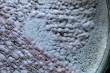 characteristic of Actinomyces, Bacteria, yeast and Mold on selective media from soil samples for study in laboratory microbiology.