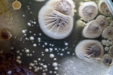 characteristic of Actinomyces, Bacteria, yeast and Mold on selective media from soil samples for study in laboratory microbiology.