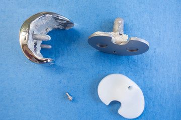 removed implants of a knee prosthesis