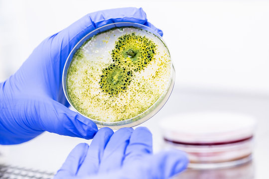 Pilzkulturen für Antibiotikum in einer Petrishale bei einem Forschungsprojekt