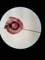 cross section : Dicot root