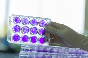 Scientist hand is holding Test plate of Dengue viruses in laboratory