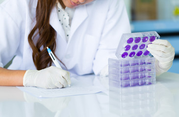 Scientist hand is holding Test plate of Dengue viruses in laboratory