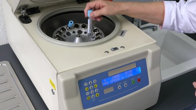 PRP preparation - patient's whole blood centrifugation in a centrifuge