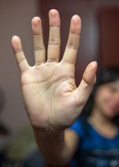 Palm of a girl with five fingers