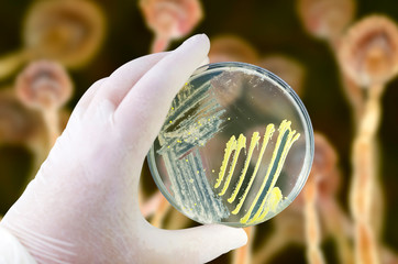 Colonies of different bacteria and mold fungi on Petri dish with nutrient agar on the fungal background, photo and 3D illustration