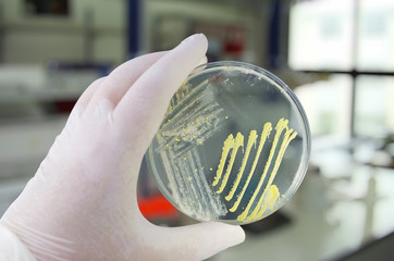 Colonies of different bacteria and mold fungi grown on Petri dish with nutrient agar, close-up view. Hand in white glove holding plate with nutrient medium in research laboratory