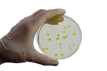 Colonies of Micrococcus luteus bacteria grown on Petri dish with nutrient agar, close-up view. Hand in white glove holding plate with nutrient medium isolated on white background