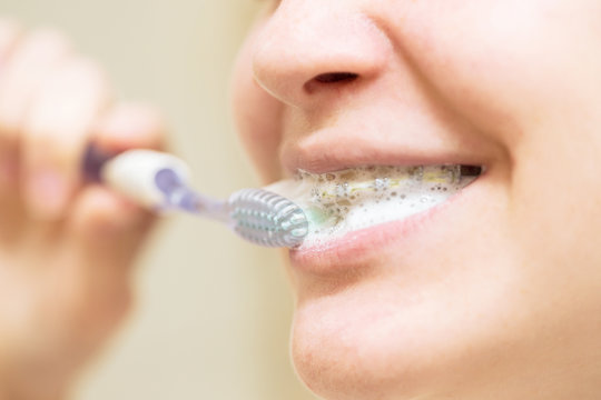 Girl With Braces Brushing Her Teeth