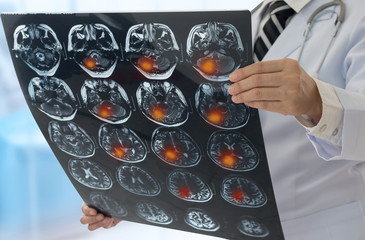 brain x-ray image