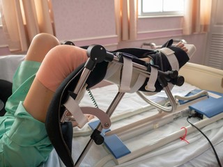 Physiotherapist do stretch exercises on patient's leg, rehabilitation for knee injury in hospithal