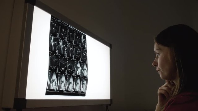 Female confidence surgery doctor looking at roentgen results at light monitor. Serious woman analysing illness of patient after diagnostic procedure . Orthopedics practice scene in emergency hospital