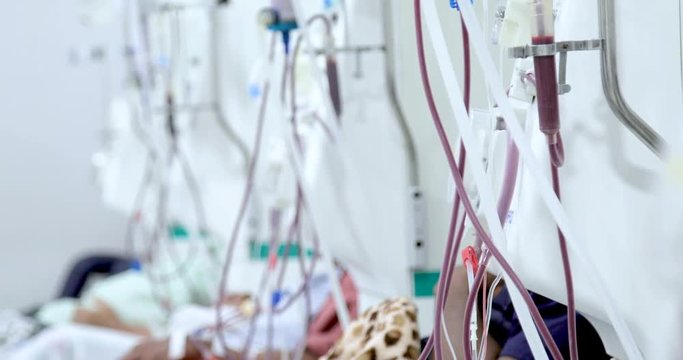 hemodialysis in people on the equipment