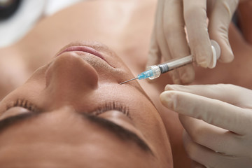 Man on rejuvenate procedure of smile lines