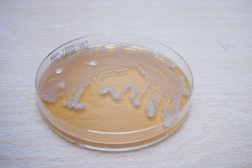 Bacteria colonies on SS agar