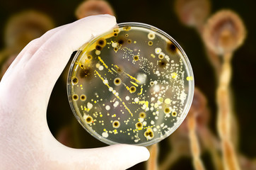 Colonies of different bacteria and mold fungi on Petri dish with nutrient agar on the fungal background, photo and 3D illustration
