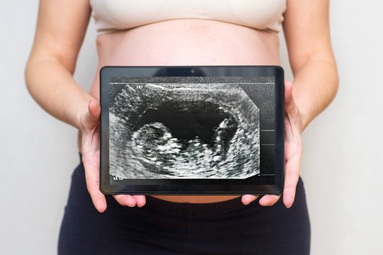 Pregnant woman shows a picture of a baby ultrasound scan on a tablet. Healthy pregnancy. Concept of Pregnancy health care