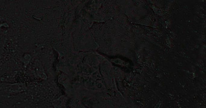 Microskopie eines Bakteriums