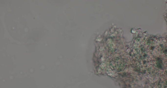 Microskopie eines Bakteriums