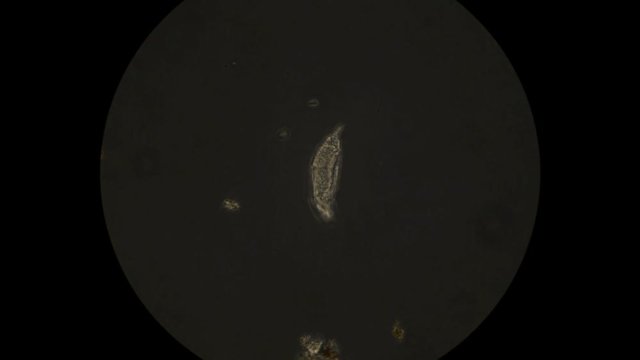 Rotatoria or rotifer as seen under microscope
