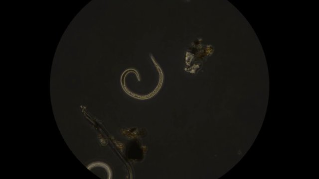 Soil nematode as seen under microscope
