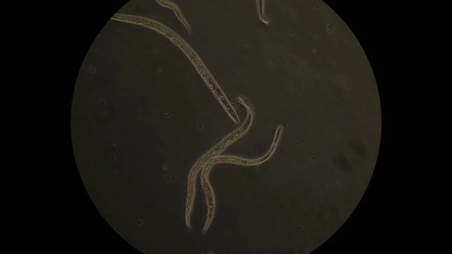 Soil nematode as seen under microscope