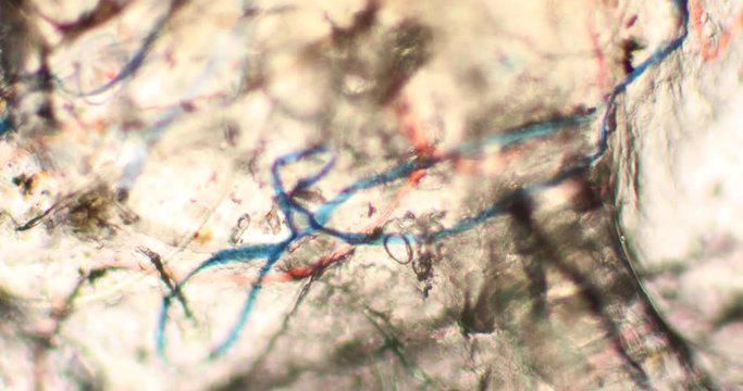 Microskopie eines Bakteriums
