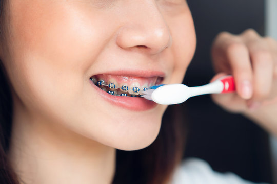 Women are brushing teeth that wear braces, in a toilet. Must maintain good oral health.