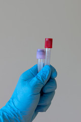 Doctor holding empty vacuum blood test tubes. Plastic medical blood tubes in hand with a blue...