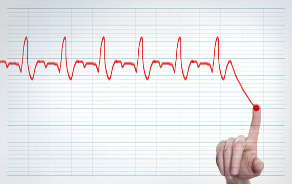 Heart pulse, one line with hand, cardiogram. Concept