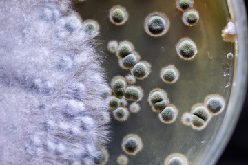 Colony characteristic of Actinomyces, Bacteria, yeast and Mold on selective media from soil samples for study in laboratory microbiology.