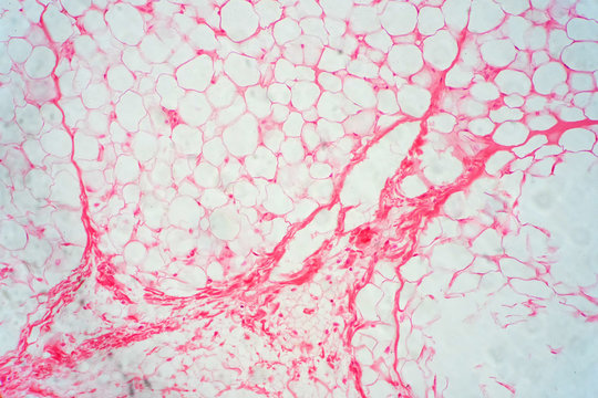 Human fat body tissue under microscope view.