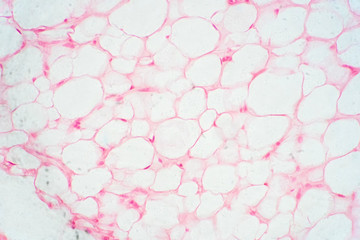 Human fat body tissue under microscope view. - obrazy, fototapety, plakaty