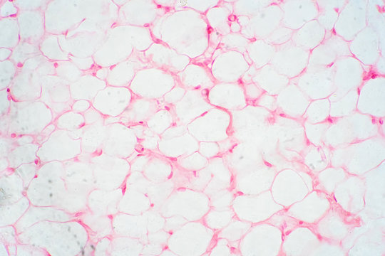 Human Fat Body Tissue Under Microscope View.