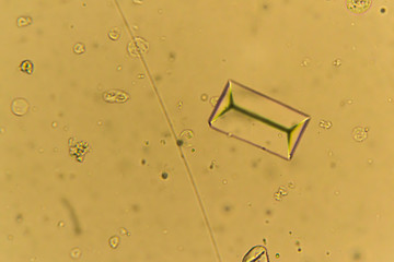 Struvites at the microscope. Urine sample from a dog who urinate frequently
