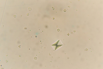 Calcium oxalate at the microscope. Urine sample from a cat with urinary infection