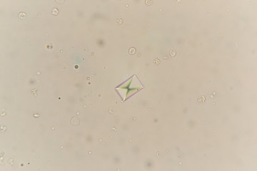 Calcium oxalate at the microscope. Urine sample from a cat with urinary infection