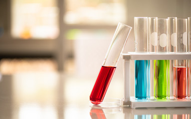 Lab working chemical testing medical,Colored liquids
