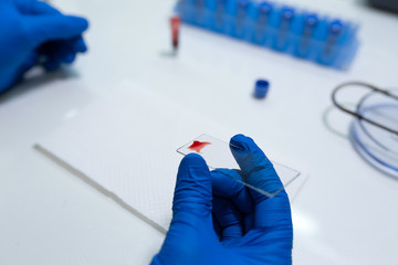 scientist prepare blood sample for research on microscope. Placing blood sample on microscope slide. Science and medicine concept