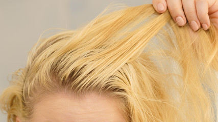 Blonde woman having greasy hair - obrazy, fototapety, plakaty