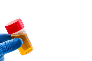 Doctor holds urine sample for test and analysis conceptual image on white background