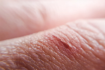A small macrol wound on a human finger. Cut skin of the hand.