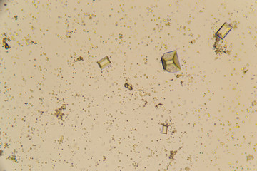 Urine crystals, red blood cells and leukocytes at the microscope. Urinary tract disease in cat