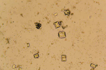 Urine crystals, red blood cells and leukocytes at the microscope. Urinary tract disease in cat