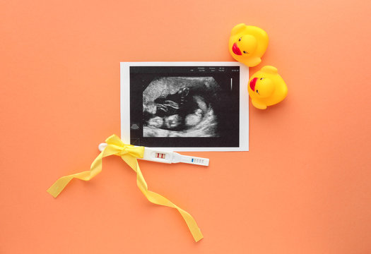 Sonogram image, pregnancy test and toy ducks on color background