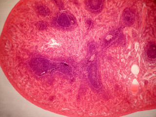 Spleen tissue.